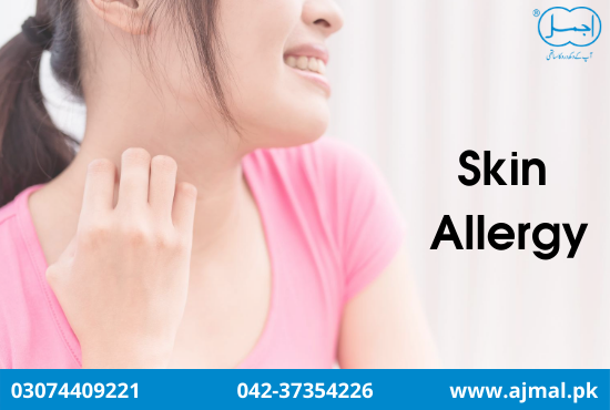 Skin Allergy