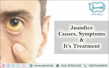 Causes of Jaundice