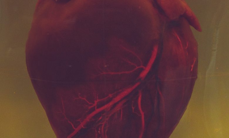 heart valve
