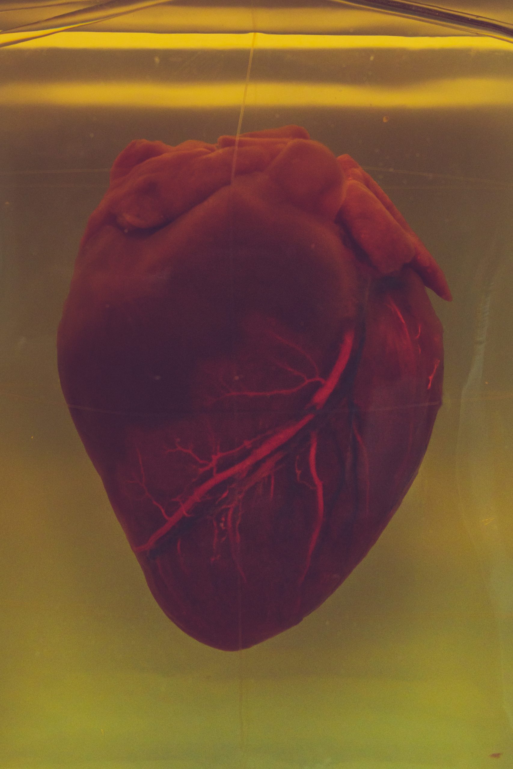 heart valve