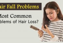 hair loss specialist- what are the most common problems of hair loss?