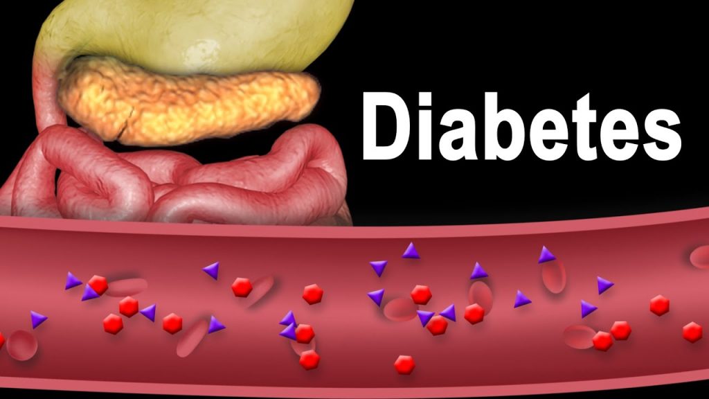 Diabetes