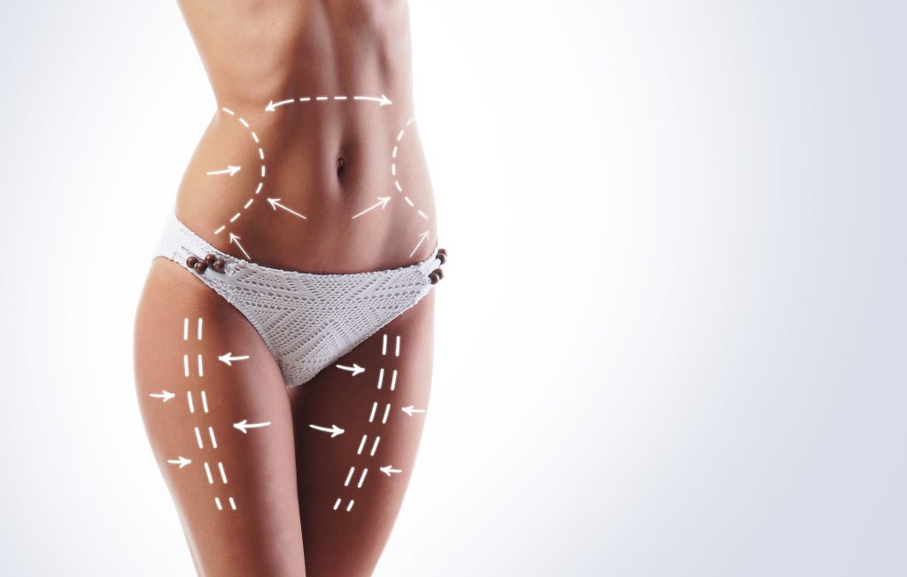 stomach liposuction