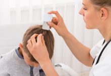 How Lice Doctor Can Help You in Getting Rid of The Head Lice