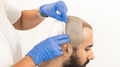 Explain The Procedure And Success Rate of FUT Hair Transplant Method