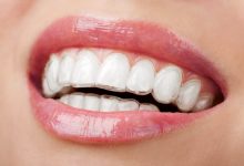 https://www.perfectsmile-dental.com/treatments/invisalign/